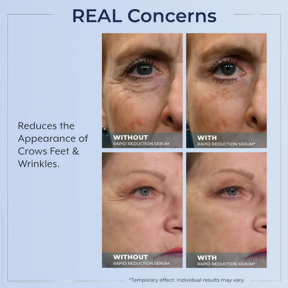 Plexaderm Rapid Reduction Serum - Visibly Reduces Under-Eye Bags & Wrinkles Instant eye serum that visibly reduces under-eye bags, puffiness, wrinkles & dark circles in minutes, lasting up to 10 hours