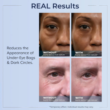Plexaderm Rapid Reduction Serum - Visibly Reduces Under-Eye Bags & Wrinkles Instant eye serum that visibly reduces under-eye bags, puffiness, wrinkles & dark circles in minutes, lasting up to 10 hours